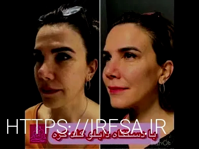 بهترین دکتر هایفو نی نی سایت